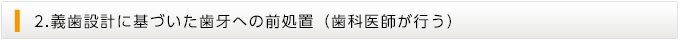 義歯設計に基づいた歯牙への前処置（歯科医師が行う）